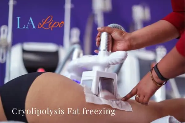 women getting fat freezing Woodham Ferrers