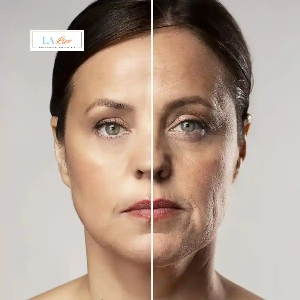 How Can You Tell If Non-Surgical Skin Tightening Is Right for You Woodham Ferrers?