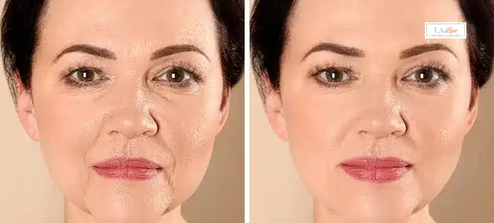 Why Aren’t My Skincare Products Making My Sagging Skin Look Firmer Woodham Ferrers?
