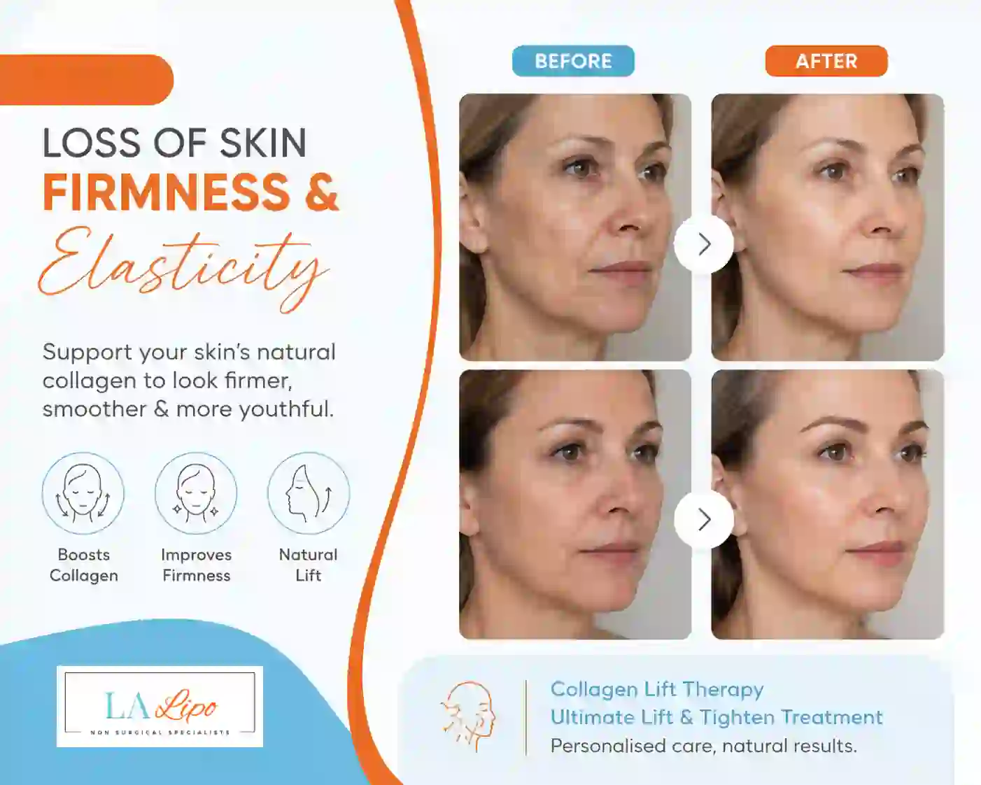 Sign #7: Loss of Skin Firmness and Elasticity Woodham Ferrers